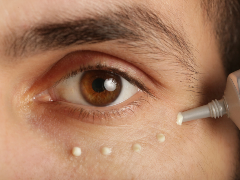 Sử dụng kem trị thâm mắt cần lưu ý lựa chọn sản phẩm chất lượng, thương hiệu uy tín.