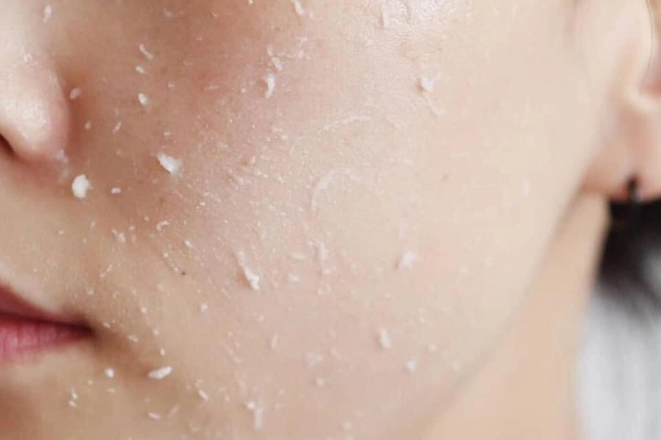 Tẩy tế bào chết giúp làn da trẻ khỏe và tăng khả năng hấp thụ dưỡng chất các sản phẩm chăm sóc da.