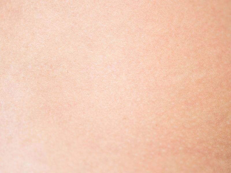 Da thường có xu hướng khỏe mạnh, ít gặp vấn đề về da hơn so với các loại da mặt cơ bản khác.