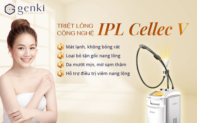 Công nghệ IPL Cellec V triệt lông vĩnh viễn tại Genki Dermatology.