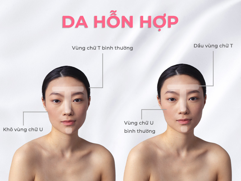 Da hỗn hợp được chia thành 2 loại: thiên dầu và thiên khô.