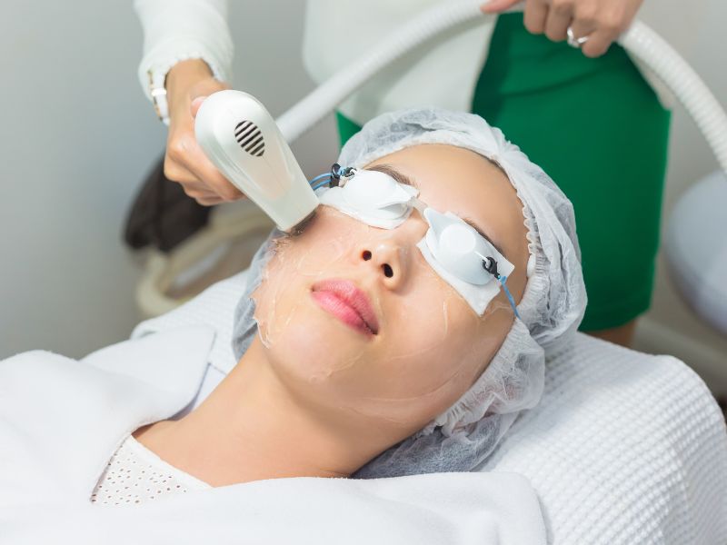 Chăm sóc da sau laser đặc biệt quan trọng, quyết định đến hiệu quả điều trị.