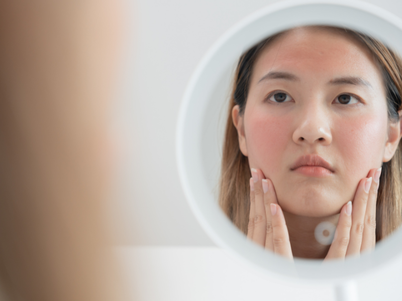 Da mặt bị dị ứng nổi sần ngứa có thể được giảm thiểu bằng những giải pháp đơn giản.