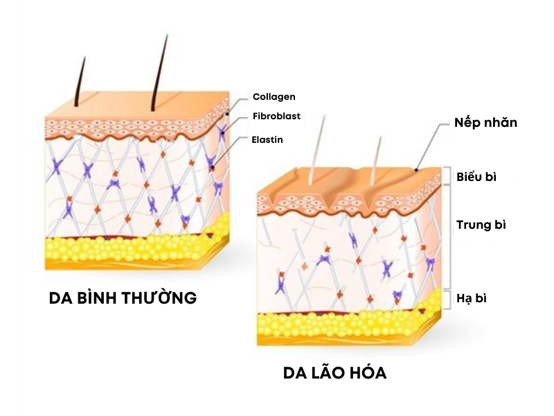 Collagen và Elastin sẽ giảm dần theo tuổi tác, đó là lý do khiến da lão hóa xuất hiện các nếp nhăn.