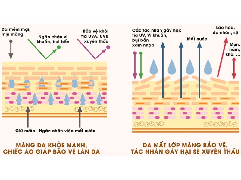 Khi làn da bị mất đi hàng rào bảo vệ, bạn sẽ phải đối mặt với nhiều vấn đề da nghiêm trọng.