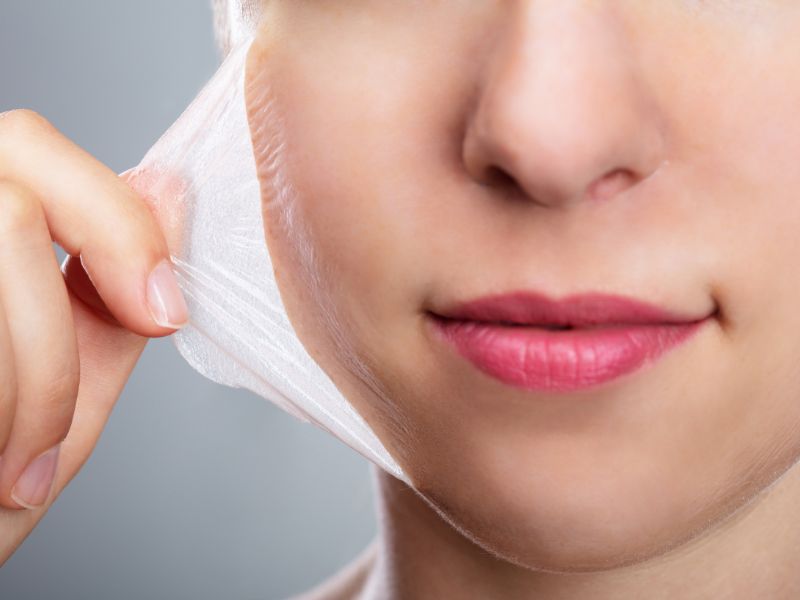 Peel da trị mụn sẽ giúp bạn lấy lại làn da mịn màng, ngăn mụn tái phát hiệu quả.