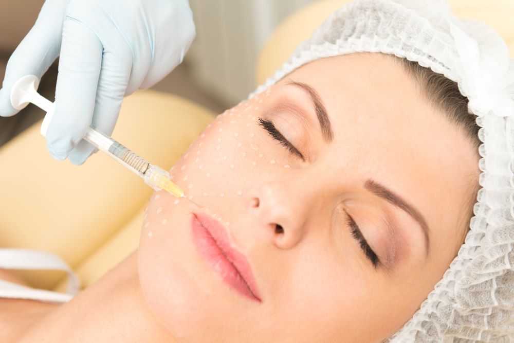 Kỹ thuật tiêm Mesotherapy sử dụng mũi kim rất nhỏ để đưa hoạt chất vào tầng trung bì của da.