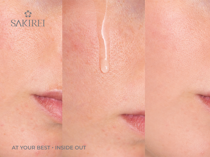 Làn da trước và sau khi dùng serum phục hồi da Sakirei NMN Revitalize Serum, kết cấu serum lỏng nhẹ thẩm thấu nhanh